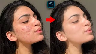 Face Retouching  Best Photoshop Tutorial  Skin Retouching [upl. by Essenaj]