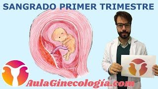 SANGRADO PRIMER TRIMESTRE Diagnóstico diferencial causas ecografía  Ginecología y Obstetricia [upl. by Eytak887]