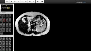 Web DICOM Viewer [upl. by Mettah]