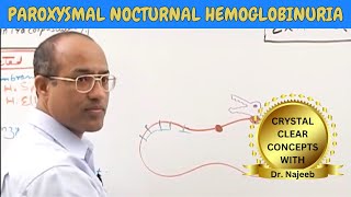 Paroxysmal Nocturnal Hemoglobinuria  Pathophysiology🩺 [upl. by Cockburn]