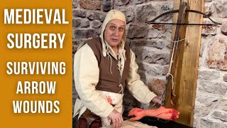 Medieval Surgery  Arrow Removal Techniques [upl. by Iago187]