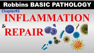 Chp3 Part1 Robbins Basic Patho  Inflammation amp Repair  PAMPs  DAMPs  Toll Like Receptors [upl. by Etienne379]