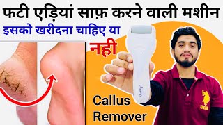 फटी एड़िया साफ़ करो 2 मिनट में  Vandelay Electric Foot Callus And Dead Skin Removal Device [upl. by Tnilf]