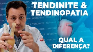 Tendinite e Tendinopatia [upl. by Noy]