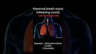 Wheezingabnormal breath soundAsthmaCOPDBronchitisHow to different wheezing soundMed school way [upl. by Ursa]