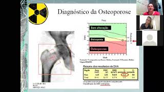 AULA DENSITOMETRIA ÓSSEA  PARTE 01 [upl. by Eelrahc]