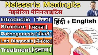 Neisseria Meningitidis Microbiology  Neisseria Meningitidis in hinid  What is Meningitidis [upl. by Bremble360]