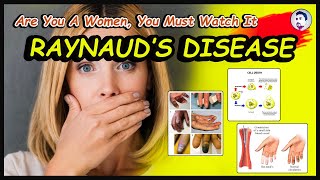 What is Raynaud Disease  Causes  What are the Treatments  Complications  English  2022 [upl. by Hildy]