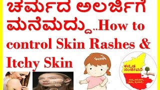 home remedies for skin rashesallergies and itchy skinkannada Sanjeevani [upl. by Cathie]