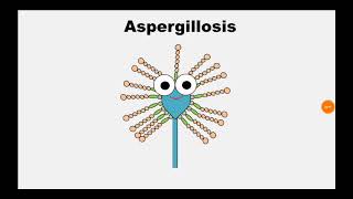 5 Aspergillosis [upl. by Devora]