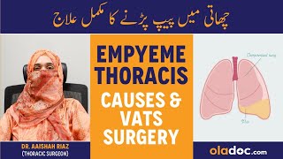 Empyema Thoracis Stages And Advanced VATS Treatment  Chaati Me Peep Parna  Best Chest Surgeon [upl. by Rodd]