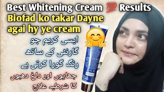 Wynn Brightening Cream Review  Brightening Depigmentation cream Review By Staywithmadiha [upl. by Tewell]