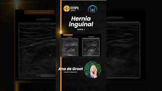 Hernia inguinal y ecografía con Ana de Groot Parte 1 ecografia fisioterapia [upl. by Pasahow]