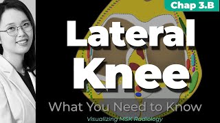 Chapter 3B⎜Lateral and Posterolateral Corner Knee⎜Visualizing MSK Radiology⎜Refer to the timeline [upl. by Raseta]