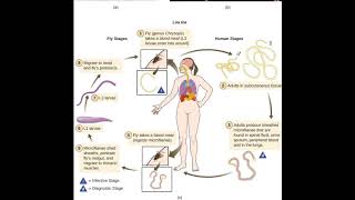 Loiasis cause pathology and diagnosis [upl. by Irafat]