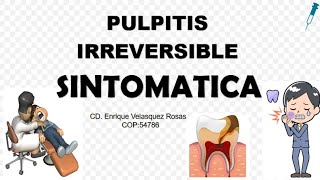 Pulpitis Irreversible Sintomática aguda o subaguda [upl. by Ragg]