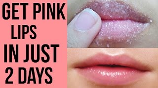 How to get pink lips Lighten dark lips naturally at home Get Rid Of Chapped Lips [upl. by Rebekah881]