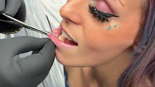 Getting Side Lip Piercing Watch the Process [upl. by Adnoral608]