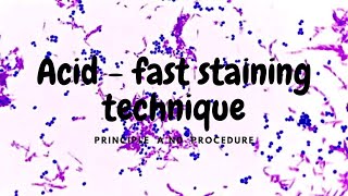 Acid fast Stain  principal and procedure [upl. by Everick]