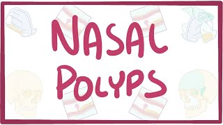 Nasal Polyps  causes symptoms diagnosis treatment pathology [upl. by Weidner]