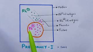 Erythroblastosis fetalis  Hemolytic anemia  Rh incompatibility  Symptoms  Bio science [upl. by Doelling]