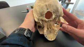 Skull Frontal Parietal and Occipital Bone and their bone markings [upl. by Yerok]