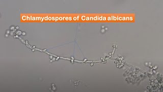 Chlamydospores of Candida albicans observation [upl. by Waugh]