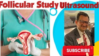 Follicular Study Ultrasound  Ovulation Study ultrasoundajaykaushik [upl. by Chiarra427]