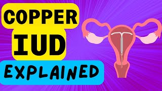 COPPER IUD EXPLAINED  INTRAUTERINE DEVICE  WHAT IS IT AND HOW IT WORKS [upl. by Acimaj]