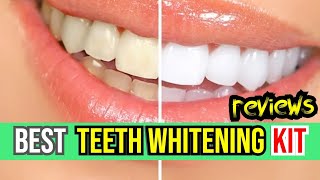 ✨ Whiten Your Smile Today 🦷 iSmile Teeth Whitening Kit Review  Best AtHome Whitening Solutions ✅ [upl. by Lanford]