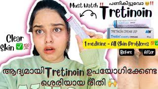 ‼️🔥Clear Skin വേണോ ⁉️😵‍💫⚠️മുഖക്കുരുകറുത്തപാടുകൾകുഴികൾ✅ How To Use Tretinoin⁉️ BEING US BY AJ [upl. by Strenta83]