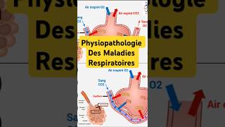 Physiopathologie Maladies Respiratoires pneumologie bronchite asthme fibrosepulmonaire poumon [upl. by Nybor330]