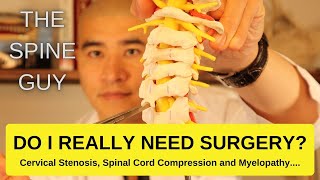 Cervical Stenosis Spinal Cord Compression and Myelopathy DO I REALLY NEED SURGERY [upl. by Jola]