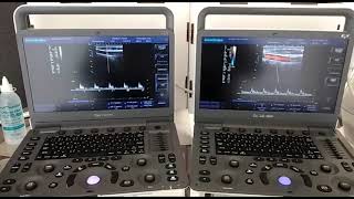 Diferença entre Doppler BW e Color Doppler  Ultrassom Veterinário [upl. by Ezmeralda]