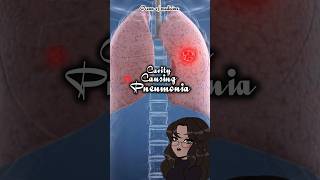 CavityCausing Pneumonia causativeorganisms shorts medicalshorts [upl. by Eixirt155]