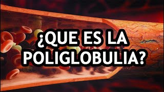 🔴 ¿QUE ES LA POLIGLOBULIA [upl. by Garnett]