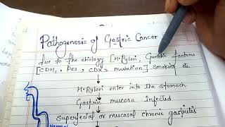 pathogenesis of gastric cancer NGMedicals [upl. by Nemzaj]