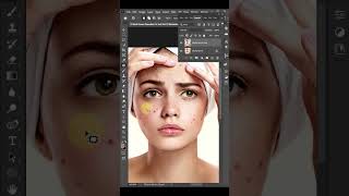 How to Remove Pimples Easily in Photoshop  for beginners shortvideo photoshoptutorial [upl. by Odnala393]