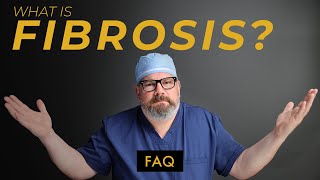 What Can You Do To Prevent FIBROSIS After Liposuction [upl. by Geno]