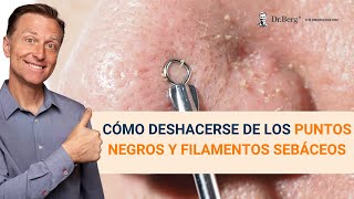 Cómo deshacerse de los puntos negros y filamentos sebáceos [upl. by Siram]