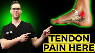 Posterior Tibial Tendonitis Treatment Inside of the Ankle Pain [upl. by Onfroi799]