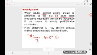 Ogilvie’s syndrome [upl. by Schmeltzer]