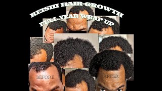 Hair Growth with MushroomsFull Year [upl. by Caria]