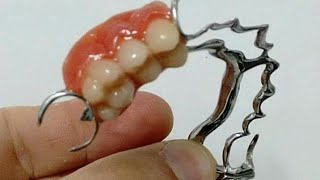 Reformando uma prótese dentária  armação de ppr [upl. by Kenna]