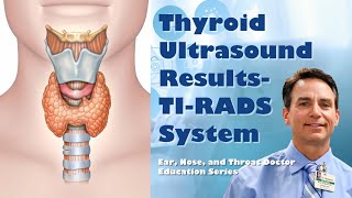 Thyroid Ultrasound Results  TI RADS rating system [upl. by Shepard]