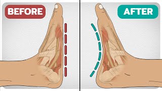 5 Exercises To Fix FlatFeet Fallen Arches [upl. by Gromme226]