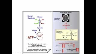 Cerebral Microdialysis [upl. by Atinihs]