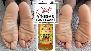 Does It work Apple Cider Vinegar Foot Soak A Natural Cure For Dry Feet [upl. by Evonne]