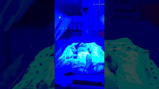 neonataljaundice hospital newborn doctor pediatrics phototherapyjaundicebaby phototherapy [upl. by Nerraf]