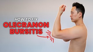 How to do exercises for Olecranon Bursitis  One cause of elbow pain in the triceps region [upl. by Ahsias]